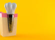 The Benefits of Dental Implants